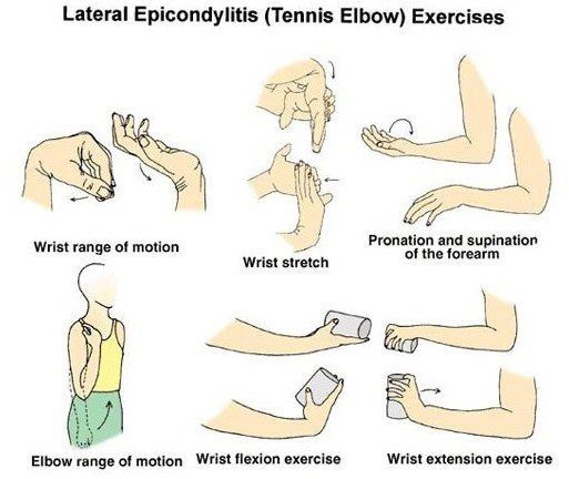 Tennis Elbow Home Physical Therapy Exercises